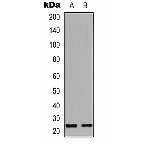 HAND1 Rabbit Polyclonal Antibody