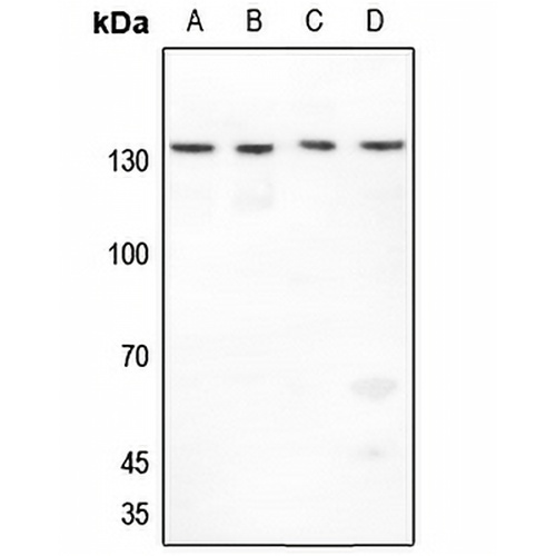 Histone Deacetylase 4 Rabbit Polyclonal Antibody
