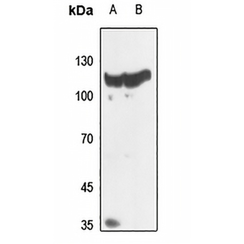 Histone Deacetylase 5/9 Rabbit Polyclonal Antibody