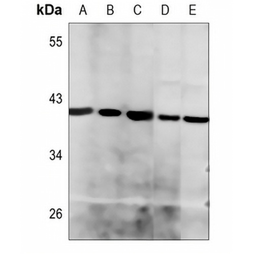 Histone Deacetylase 8 Rabbit Polyclonal Antibody