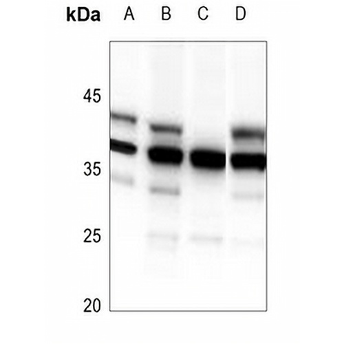 HDGFRP3 Rabbit Polyclonal Antibody