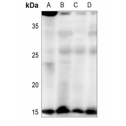 HEN1/2 Rabbit Polyclonal Antibody