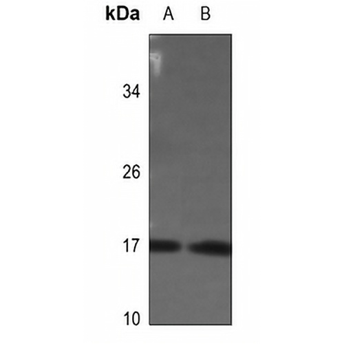 Histone H3 (Phospho-S28) Rabbit Polyclonal Antibody