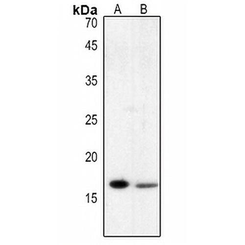 Histone H3 (Acetyl-K122) Rabbit Polyclonal Antibody