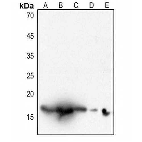 Histone H3 (Acetyl-K18) Rabbit Polyclonal Antibody