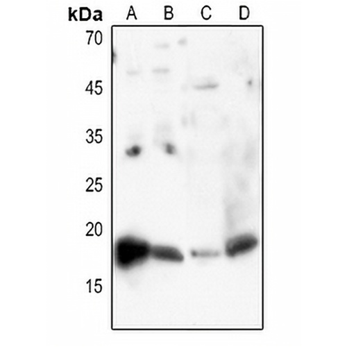 Histone H3 (Acetyl-K27) Rabbit Polyclonal Antibody