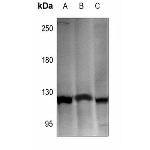 Hexokinase 1 Rabbit Polyclonal Antibody
