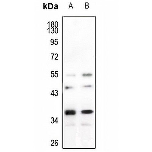 hnRNP A2/B1 Rabbit Polyclonal Antibody