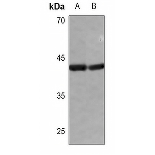 hnRNP D0 Rabbit Polyclonal Antibody