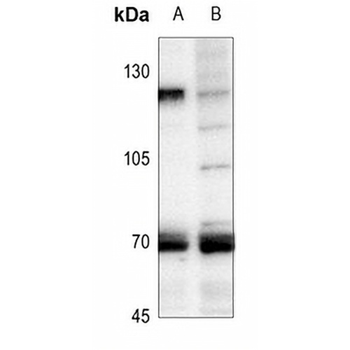HSF1 Rabbit Polyclonal Antibody