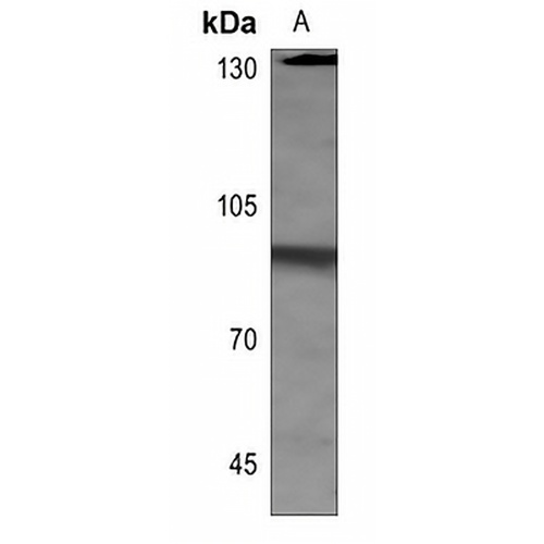 HSF1 (Phospho-S303) Rabbit Polyclonal Antibody