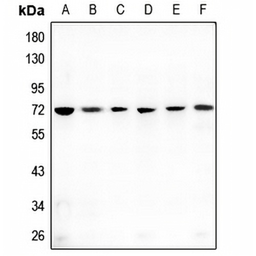 HSP70 Rabbit Polyclonal Antibody
