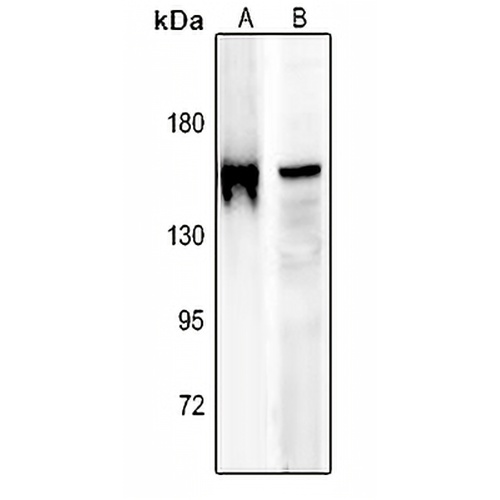 IRS1 (Phospho-S636) Rabbit Polyclonal Antibody