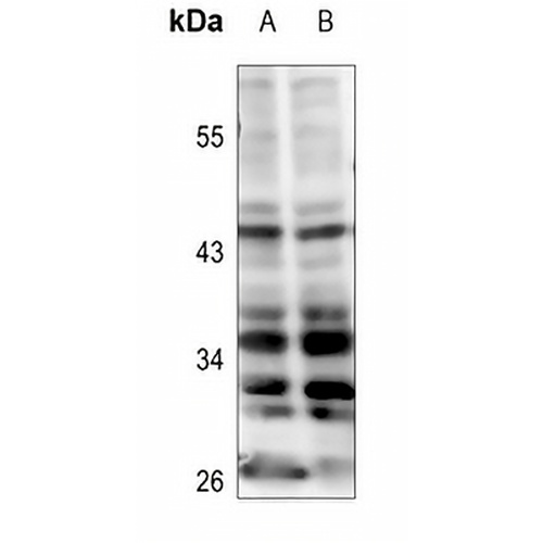 Kir6.2 Rabbit Polyclonal Antibody