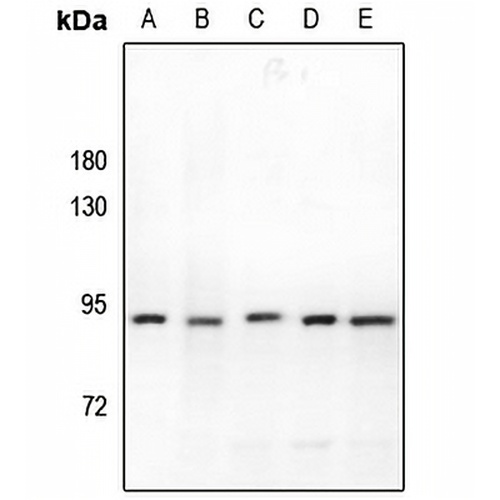 KLHL29 Rabbit Polyclonal Antibody