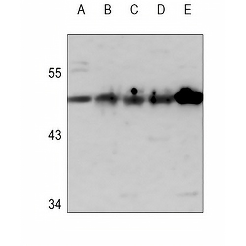 Cytokeratin 14 Rabbit Polyclonal Antibody