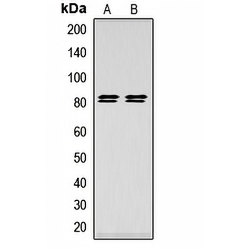 HSL (Phospho-S552) Rabbit Polyclonal Antibody
