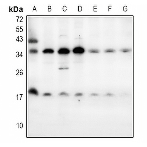 LY6E Rabbit Polyclonal Antibody