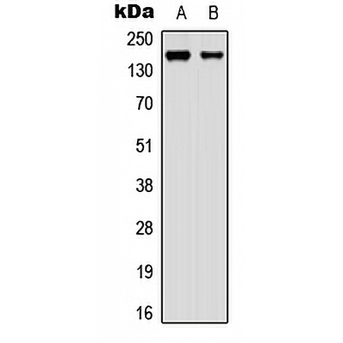 AIP-1 Rabbit Polyclonal Antibody