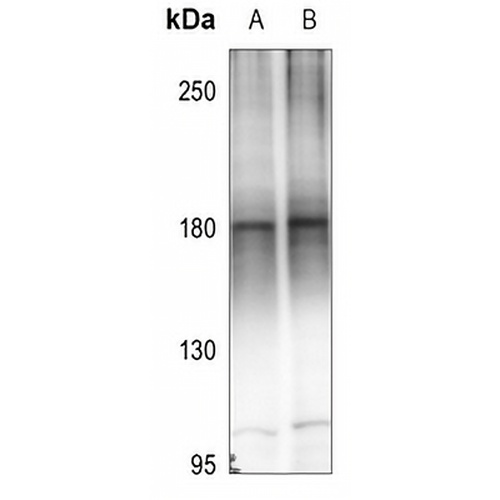 MEKK4 Rabbit Polyclonal Antibody