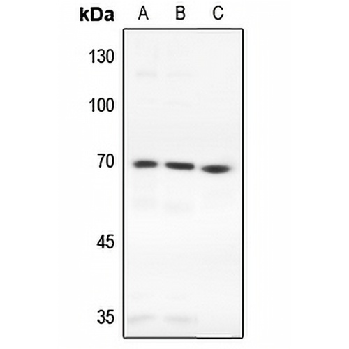 TAK1 Rabbit Polyclonal Antibody