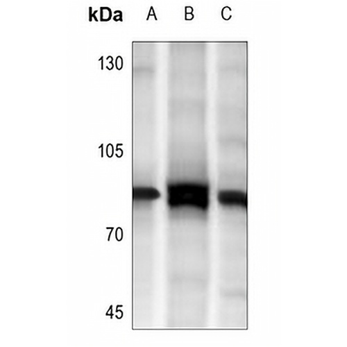 MARK3 Rabbit Polyclonal Antibody