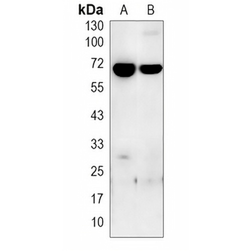 MBTPS2 Rabbit Polyclonal Antibody