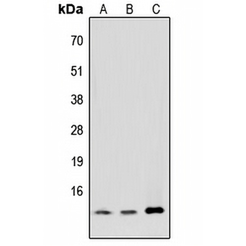 MED11 Rabbit Polyclonal Antibody