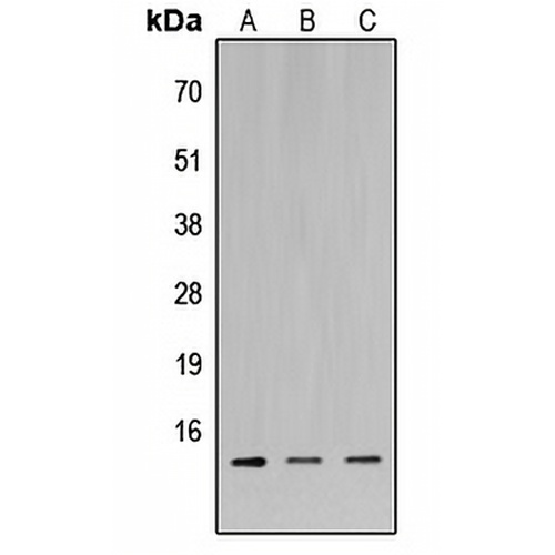 MIA1 Rabbit Polyclonal Antibody