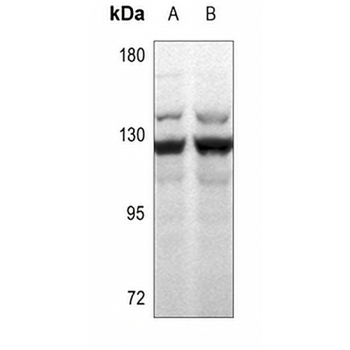 MSH3 Rabbit Polyclonal Antibody