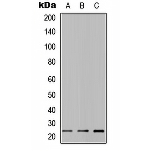 MUC16 Rabbit Polyclonal Antibody