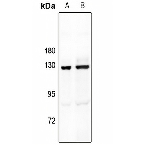 MYBPC1 Rabbit Polyclonal Antibody