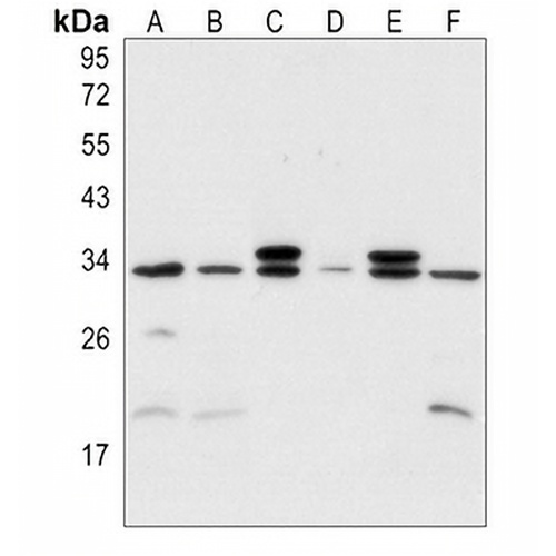 MYF5 Rabbit Polyclonal Antibody