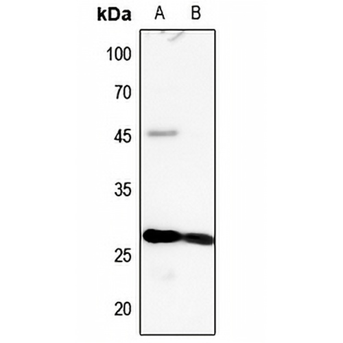 MYL3 Rabbit Polyclonal Antibody