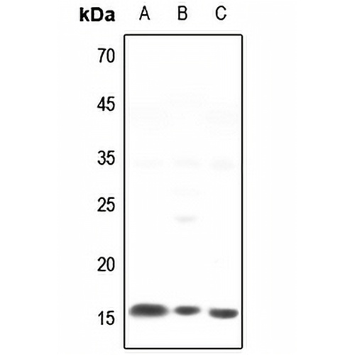 NCALD Rabbit Polyclonal Antibody