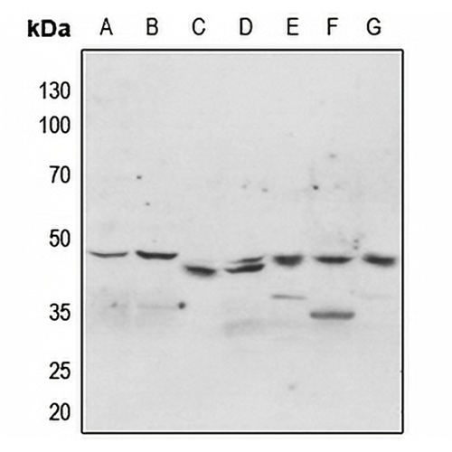 p47 phox (Phospho-S304) Rabbit Polyclonal Antibody