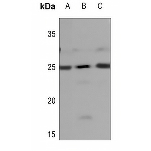 NDUFB9 Rabbit Polyclonal Antibody