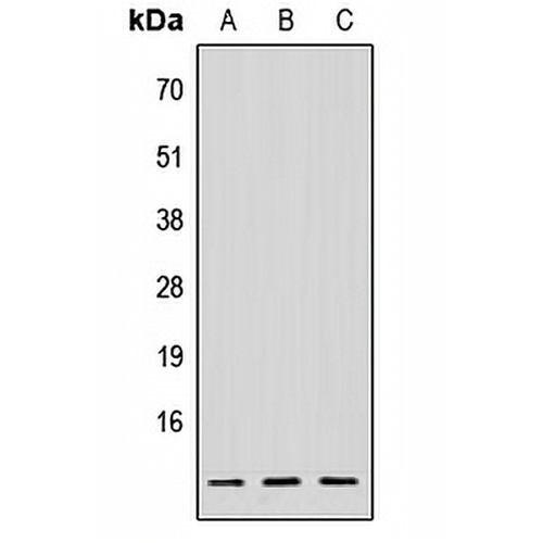 NDUFV3 Rabbit Polyclonal Antibody