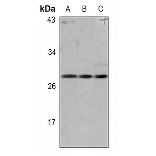 pro-NGF beta Rabbit Polyclonal Antibody