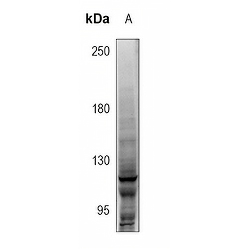 NOTCH1 Rabbit Polyclonal Antibody