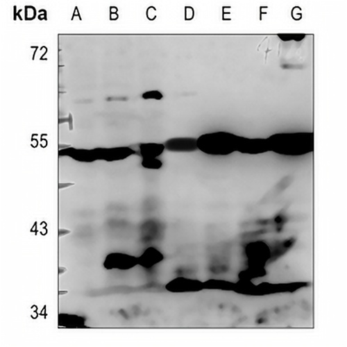 NPDC1 Rabbit Polyclonal Antibody