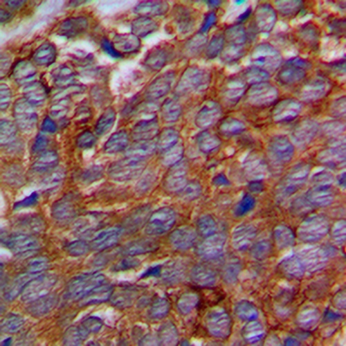 p311 Rabbit Polyclonal Antibody