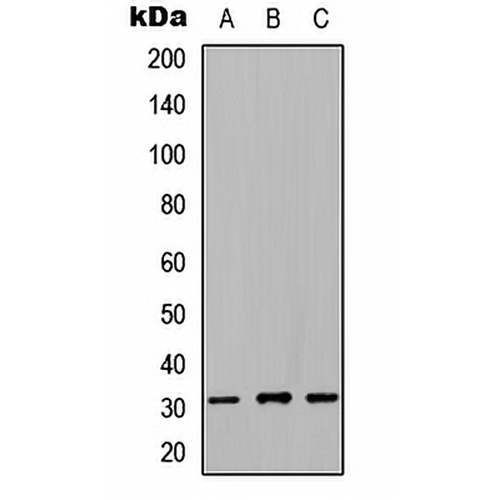 NRIP2 Rabbit Polyclonal Antibody