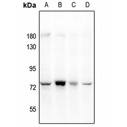 PARP3 Rabbit Polyclonal Antibody
