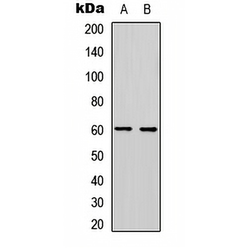 PDCD4 (Phospho-S457) Rabbit Polyclonal Antibody