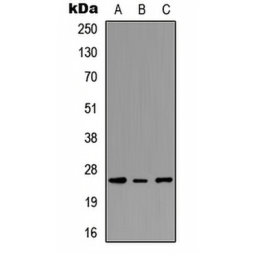 PEX11G Rabbit Polyclonal Antibody