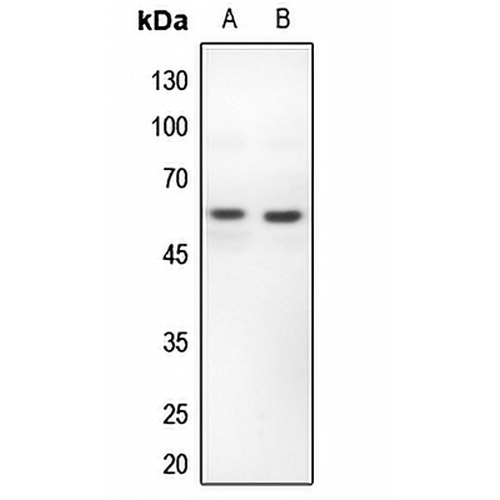 PFKFB2 Rabbit Polyclonal Antibody