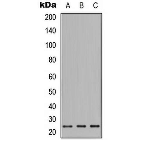 PIGF Rabbit Polyclonal Antibody