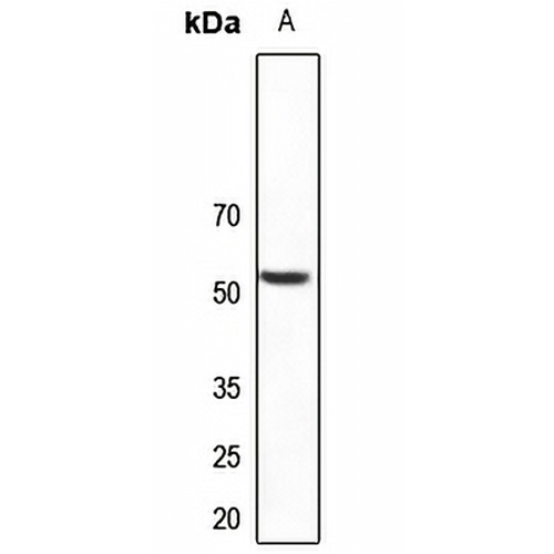 PLXDC1 Rabbit Polyclonal Antibody