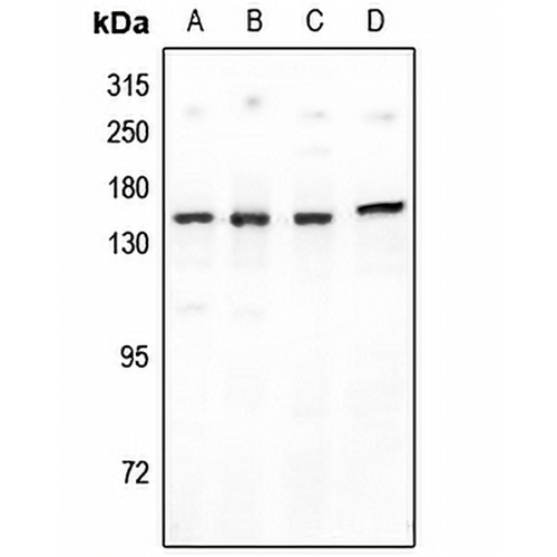 PNPLA6 Rabbit Polyclonal Antibody